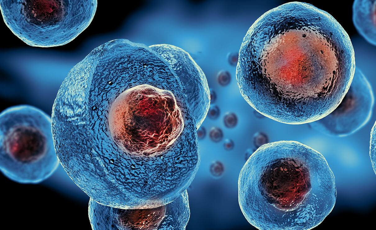 Mesenchymal Stem Cell Therapy | Multi-Care Medical of South Florida